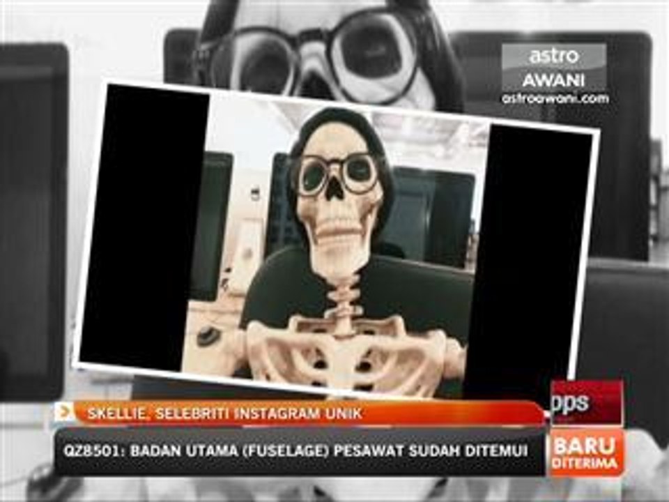 Skellie, selebriti Instagram unik