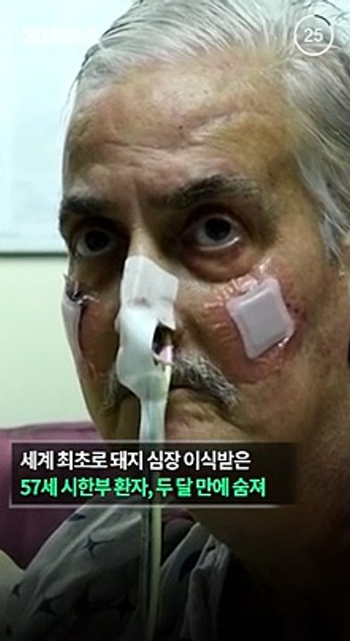 [30초뉴스] 세계 최초로 돼지 심장 이식받은 남성, 두 달 만에 숨져