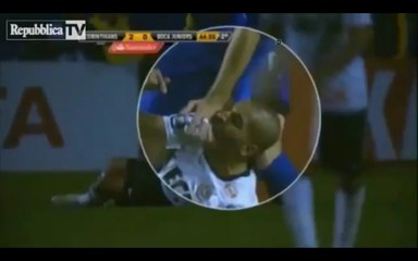 Un joueur brésilien mord son adversaire