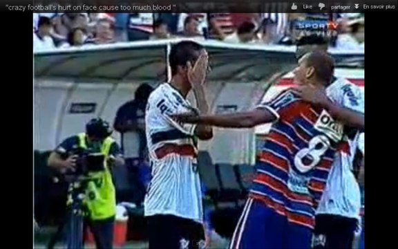 Vidéo Insolite : Un joueur brésilien blessé essuie son sang sur un autre joueur