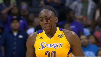 Insolite : Une basketteuse prend un coup de boule après avoir mis un panier