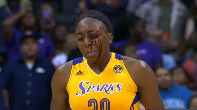 Insolite : Une basketteuse prend un coup de boule après avoir mis un panier