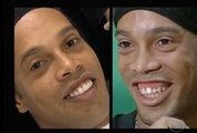 Insolite : Les nouvelles dents de Ronaldinho
