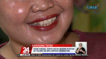 Isang ginang, nabigyan ng bagong pustiso sa tulong ng GMA Kapuso Foundation | 24 Oras