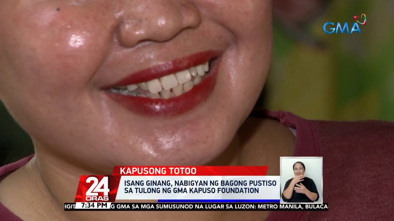 Isang ginang, nabigyan ng bagong pustiso sa tulong ng GMA Kapuso Foundation | 24 Oras