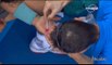 Open d'Australie 2014: Rafael Nadal victime d'une ampoule impressionnante contre Nishikori