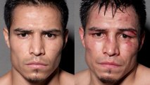 Boxe : Avant/après un combat, découvrez la différence physique incroyable des boxeurs