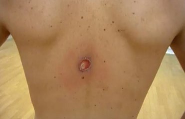 Il envoie une balle de squash sur son frère à 280 km/h en vidéo