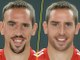 Franck Ribéry sans ses cicatrices