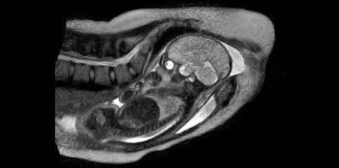 Voilà à quoi ressemble un accouchement vu de l'intérieur !