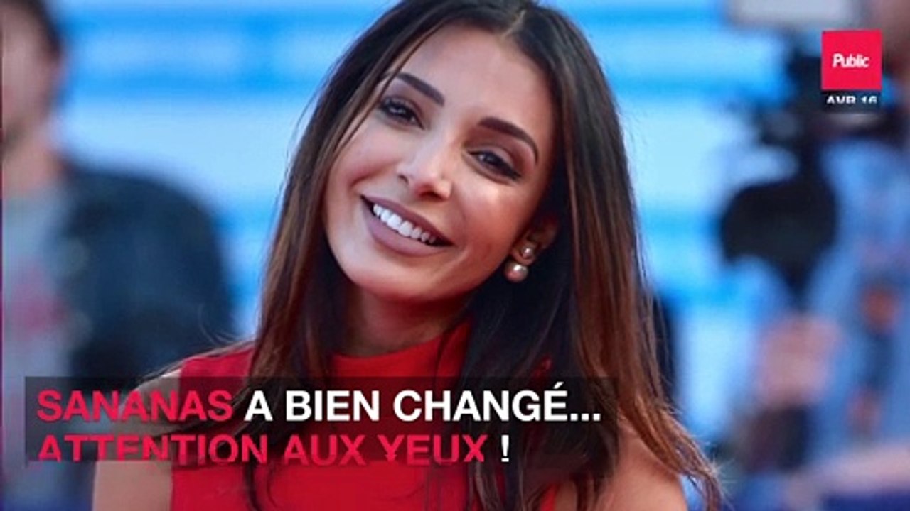 Sananas a bien changé... attention aux yeux !