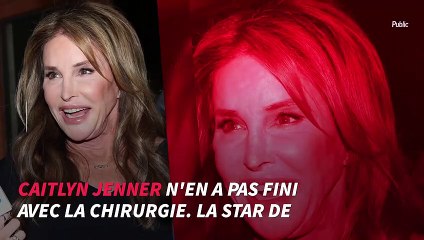 complètement défi­gu­rée après une chirurgie, la photo choc !