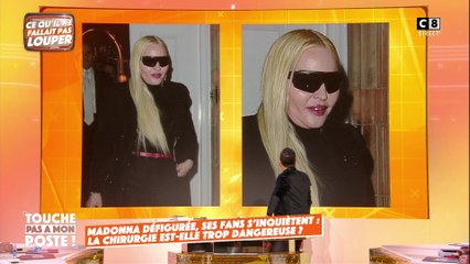 Madonna défigurée : la star a-t-elle trop abusé de la chirurgie esthétique ?