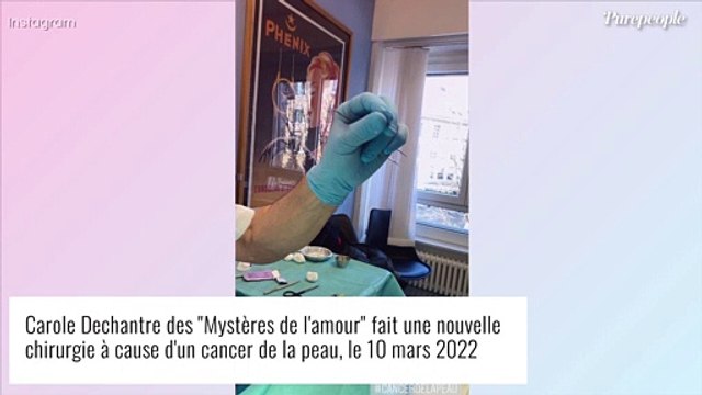 Carole Dechantre de nouveau touchée par le cancer : opération et confidences
