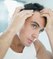 Calvitie: Comment lutter contre la chute et la perte des cheveux ?