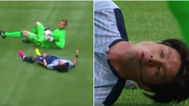 Masato Kudo, attaquant de Vancouver, complétement KO après un terrible choc en MLS