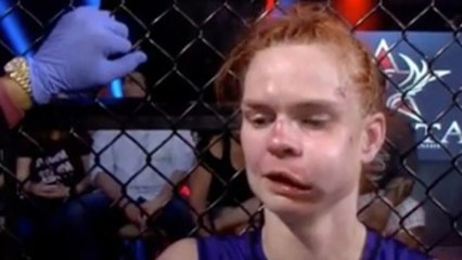 Peggy Morgan se fait défigurer après un combat de MMA