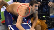 JO de Rio : pourquoi Michael Phelps avait d'étranges traces sur le corps ?
