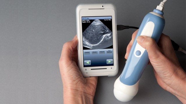 MobiUS : ce scanner à ultrasons portables se connecte à votre smartphone !