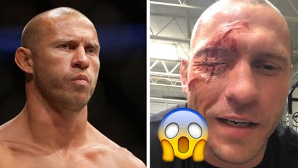 Donald "Cowboy" Cerrone affiche une terrible blessure à l'oeil : fake ou pas fake ?