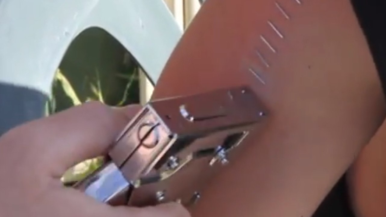 Il se met 100 agrafes dans la peau pour fêter ses 100 000 fans YouTube