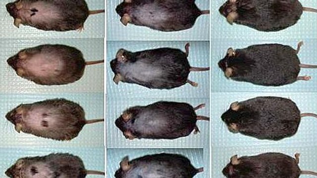 Chute de cheveux : un traitement trouvé pour lutter contre la calvitie ?