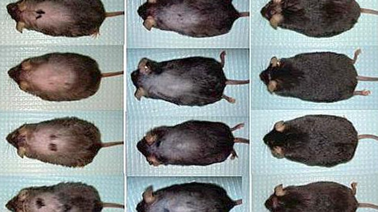 Chute de cheveux : un traitement trouvé pour lutter contre la calvitie ?