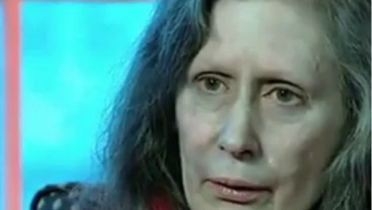 Après avoir pris des gouttes pour le nez, Rosemary Jacobs se retrouve avec la peau grise