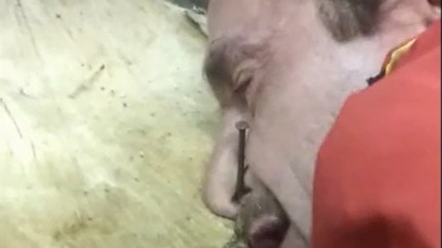 Il se fait volontairement clouer le nez sur un tronc d'arbre !