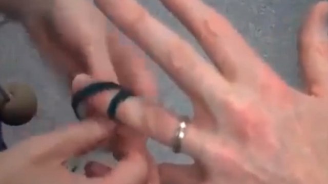 Comment retirer une bague coincée au doigt à l'aide d'un élastique ? L'astuce infaillible