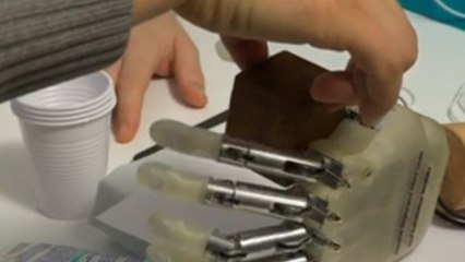 Grâce à sa main bionique, Dennis Aabo Sorensen peut à nouveau sentir ce qu'il touche