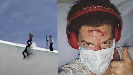 La star du snowboard Shaun White dévoile la vidéo d'une terrible chute qui lui a détruit le nez