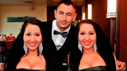 Deux jumelles partagent le même homme et une passion pour la chirurgie esthétique