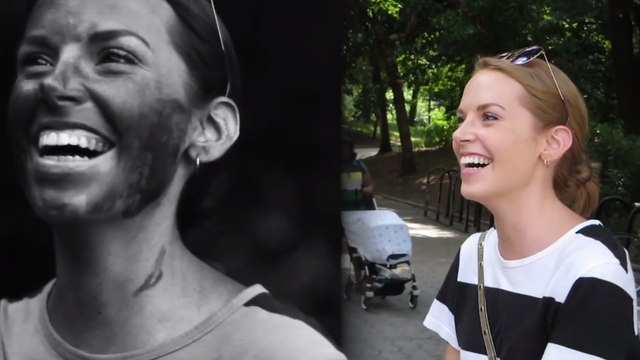 Découvrez les vrais effets du soleil sur votre visage grâce à une caméra spéciale