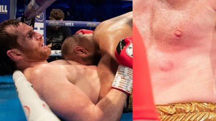 Le boxeur Kash Ali pète les plombs, plaque au sol puis mord au ventre David Price !