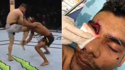 Bontorin inflige un sale KO en provoquant une horrible coupure à Paiva sur coup de genou (VIDÉO)