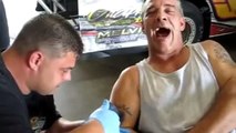 Il se fait retirer un tatouage avec une technique très douloureuse