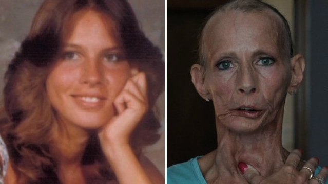 Le témoignage de cette femme va vous donner immédiatement envie d'arrêter de fumer