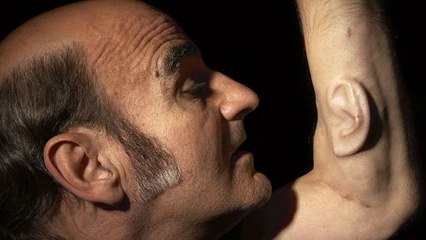 Stelarc : Cet artiste fait pousser une oreille connectée sur son bras