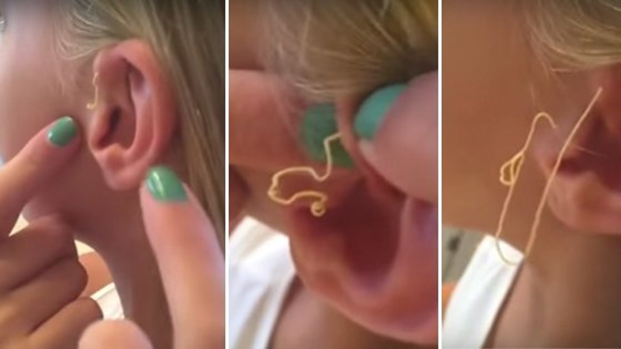 Elle éclate un bouton vieux de 6 ans sur son oreille. Ce qui en sort est à peine croyable.