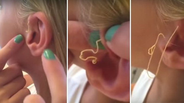 Elle éclate un bouton vieux de 6 ans sur son oreille. Ce qui en sort est à peine croyable.