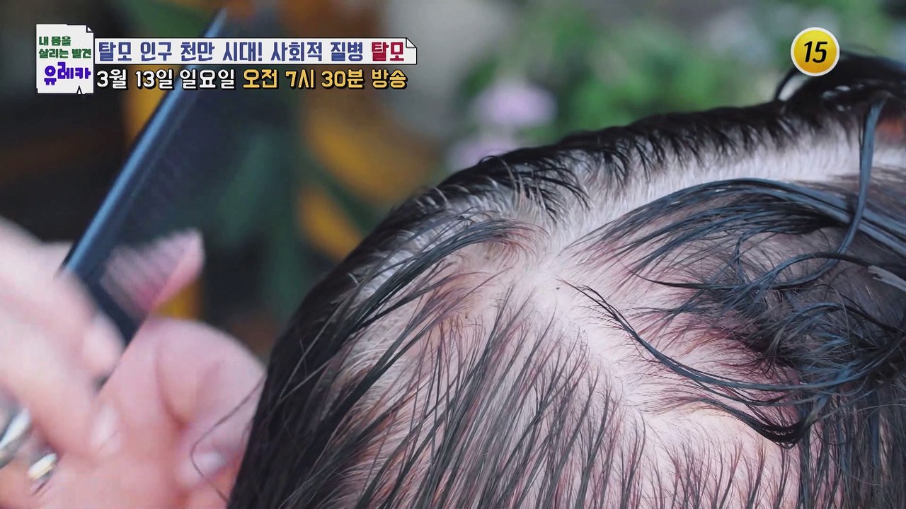 탈모 인구 천만 시대! 사회적 질병 탈모_내 몸을 살리는 유레카 56회 예고 TV C...