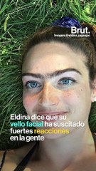 Esta joven desafía los cánones de belleza a través de su vello facial