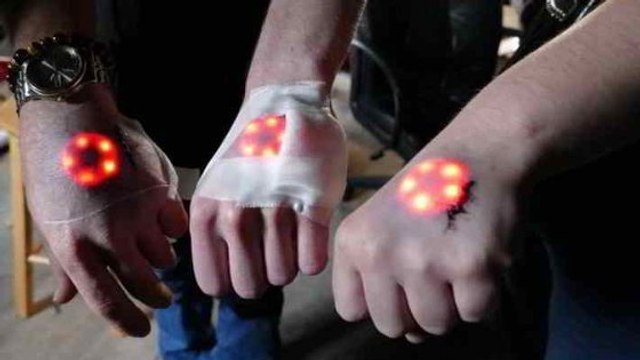 Northstar V1 : les LED sous la peau, la nouvelle tendance en matière de modification corporelle