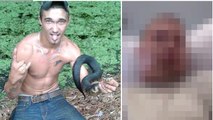 Il se retrouve avec le visage déformé après avoir tenté d'embrasser un serpent