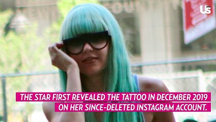 Amanda Bynes Is Getting the Heart-Shaped Tattoo on Her Face Removed