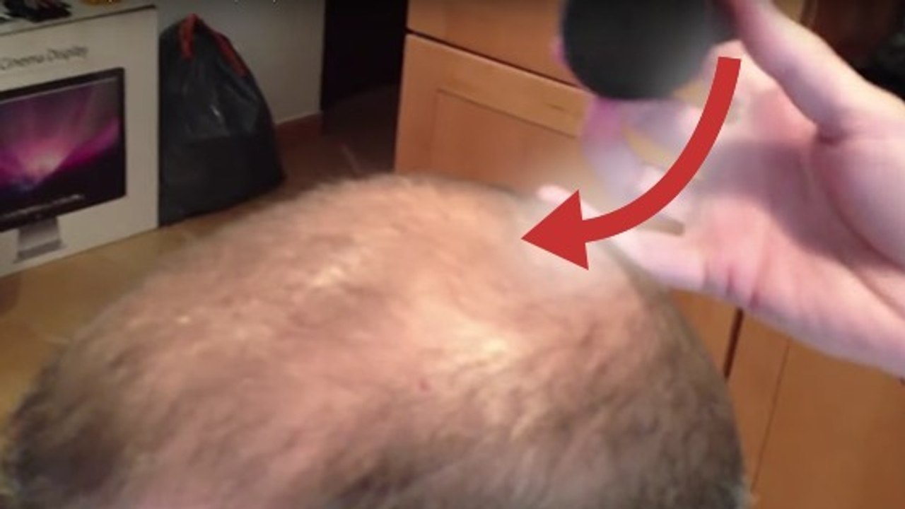 Caboki, le produit miraculeux pour faire disparaître la calvitie