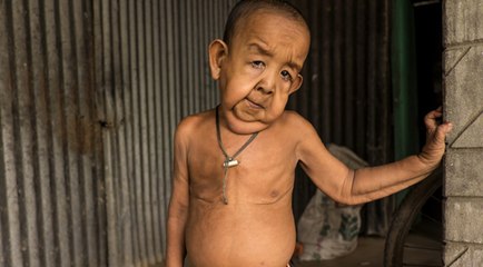 Bayezid Hossain : âgé de 4 ans, cet enfant est surnommé le 'Benjamin Button du Bangladesh'