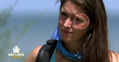 Koh-Lanta : un détail sur le visage de Claire a interpellé les internautes