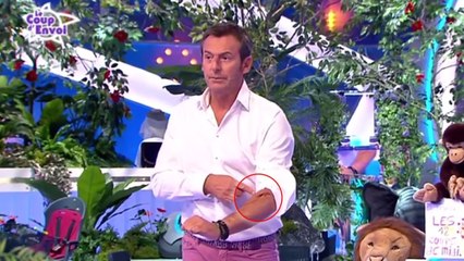 Jean-Luc Reichmann : l'animateur soulève la manche de sa chemise et dévoile les stigmates d'un grave accident de moto